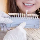 ホワイトニング